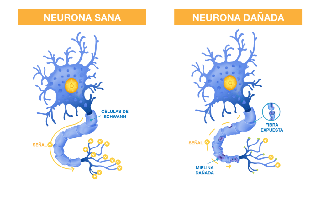 Comparativo neuronas