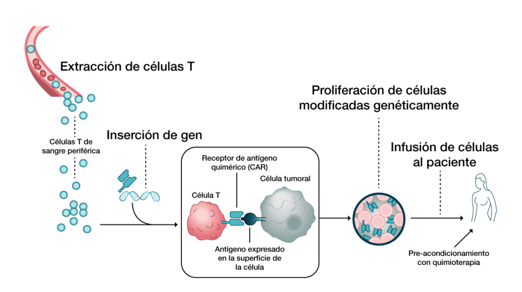 Figura 3. Secuencia de pasos para la terapia con células CAR-T