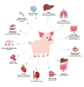 xenotransplante