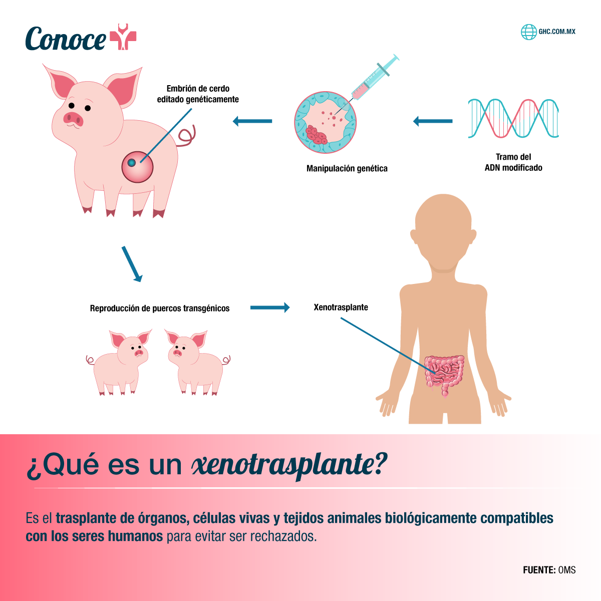 Conoce Más ¿Qué es un xenotrasplante?